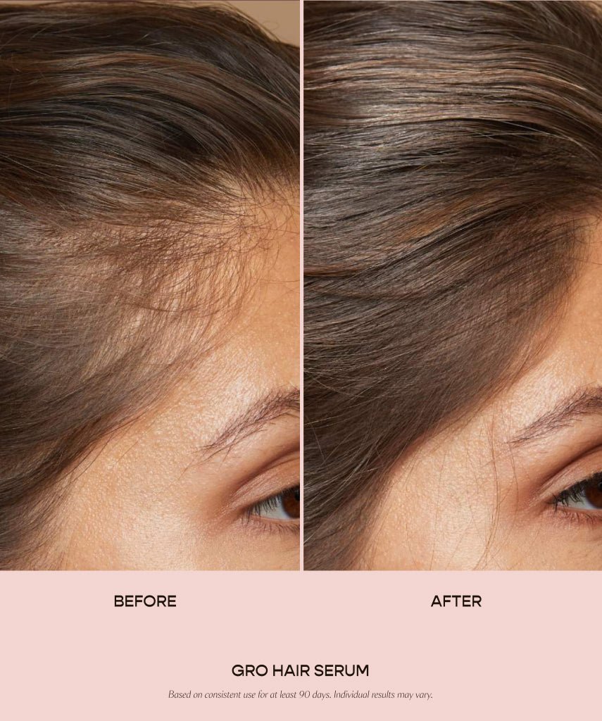 Adorelle ™ | GRO Hair Serum - Adorelle