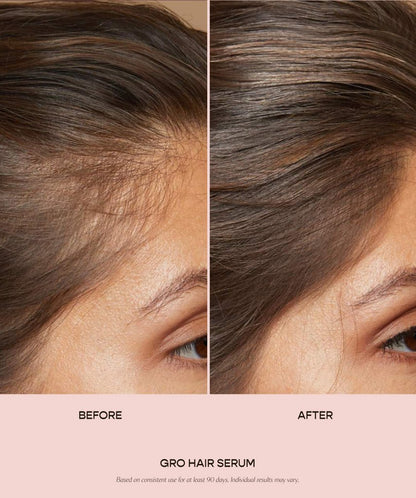 Adorelle ™ | GRO Hair Serum - Adorelle